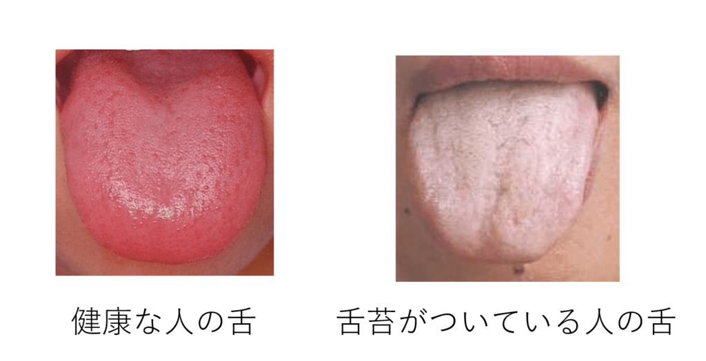 舌苔