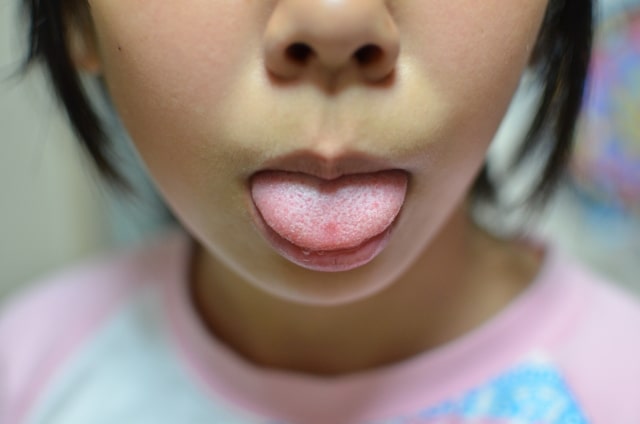 舌苔　原因　アイキャッチ